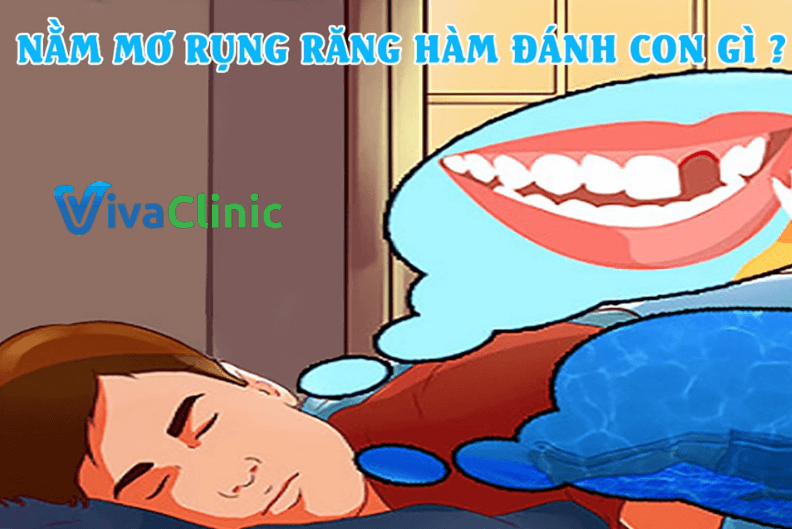 Cách Hóa Giải Giấc Mơ Rụng Răng