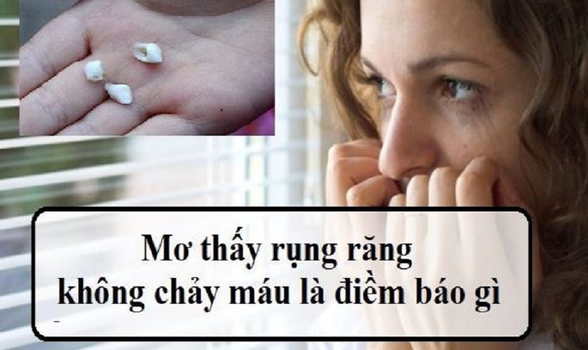 Giải mã tất tần tật những ý nghĩa khi nằm mơ thấy rụng răng